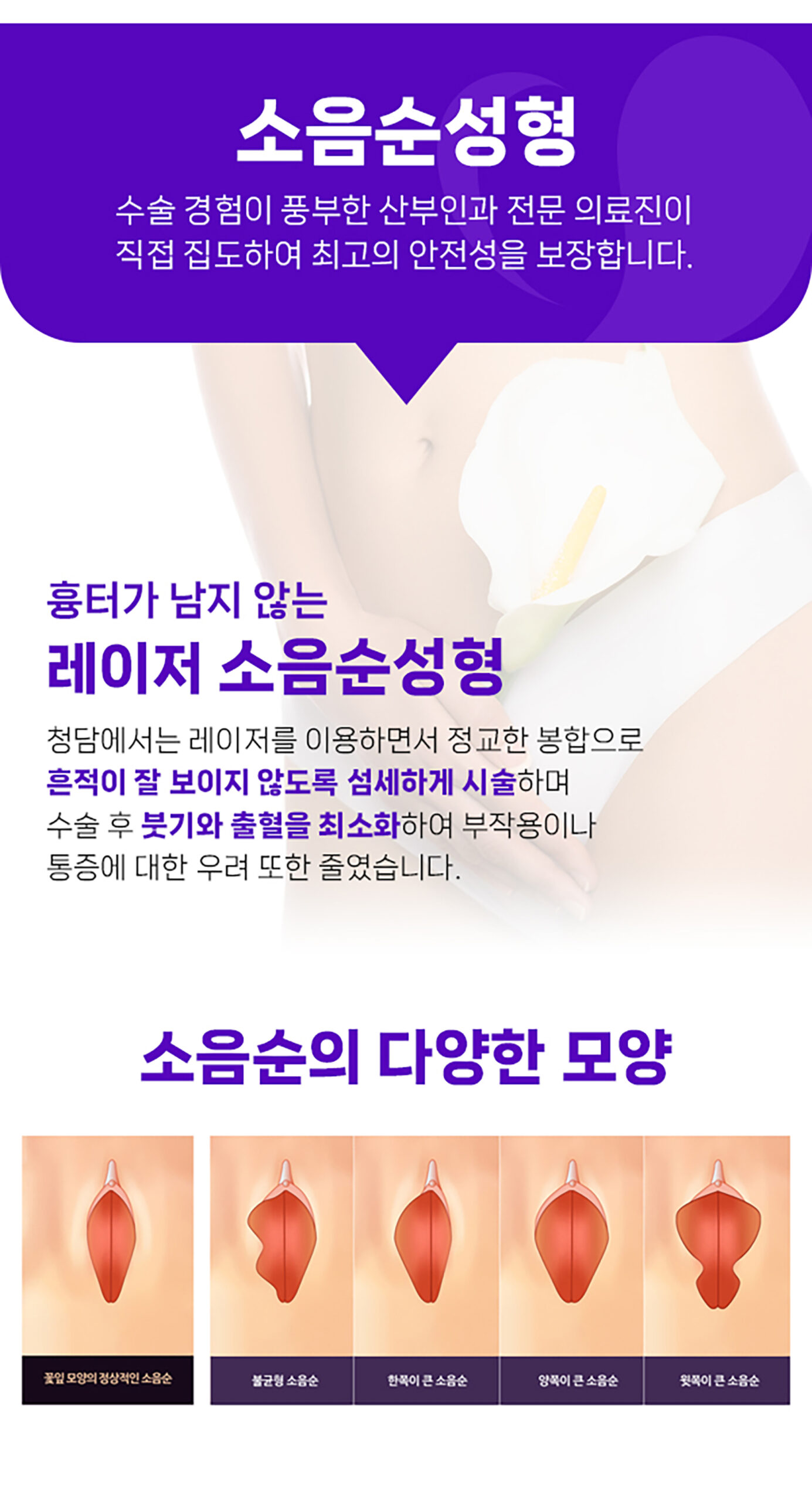 청담산부인과-랜딩페이지_모나리자&소음순_04